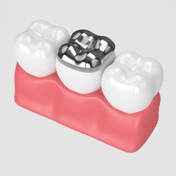 Types of Dental Fillings Which One Is Right for You