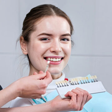 The Process of Getting Composite Veneers