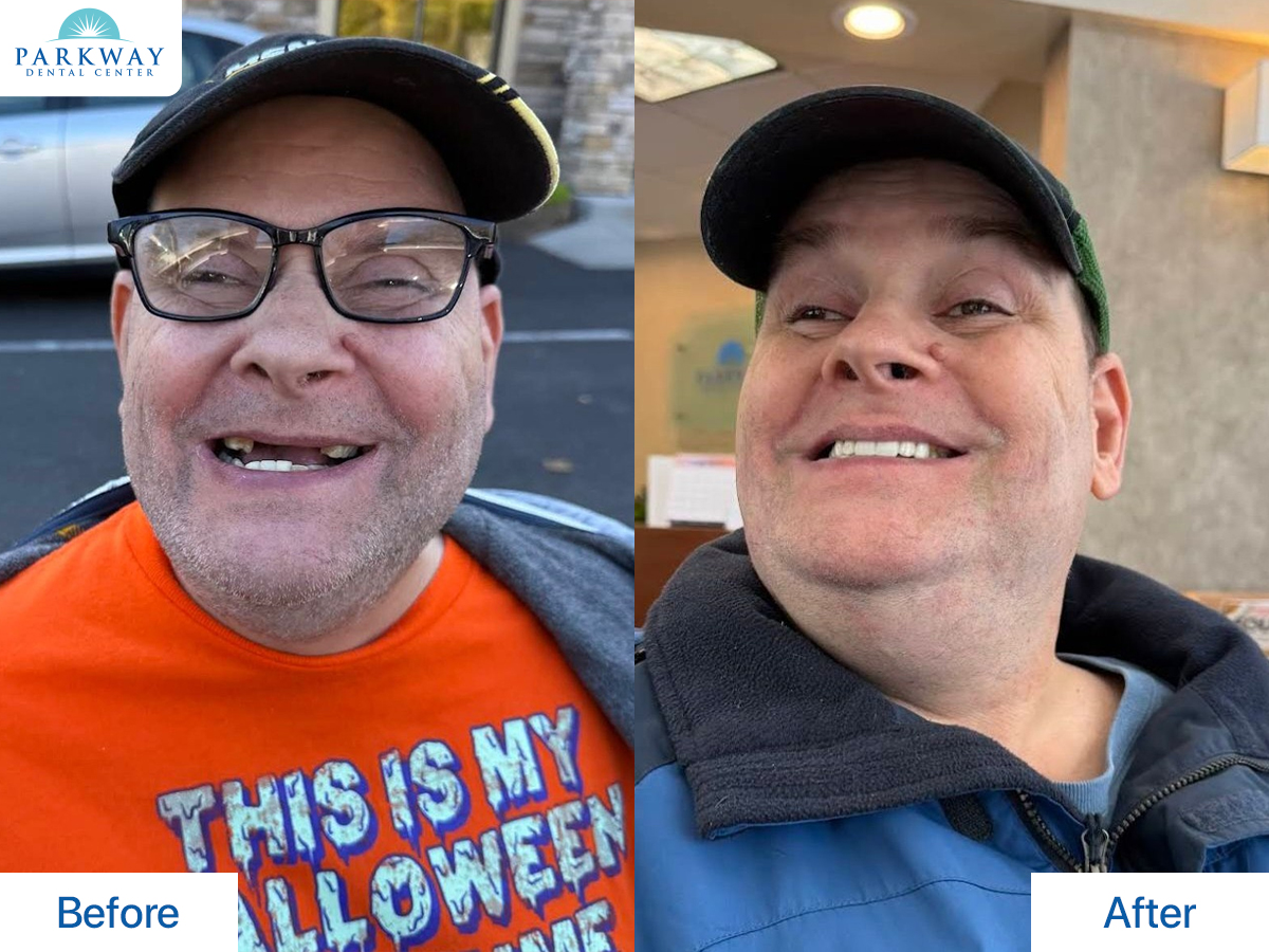 Patient Before and After Transformation