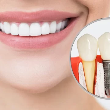 dentist in Minneapolis